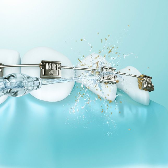 Puikiai nuvalo ortodontinius įtaisus